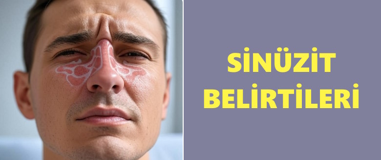Sinüzit Belirtileri - Sinüzit Nedir ve Bitkisel Tedavi Yöntemleri